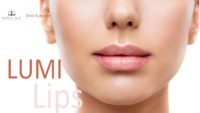 The Art & Science of Youthful Yet Natural-Looking Lips, Lip fillers perfected at Luminisce.